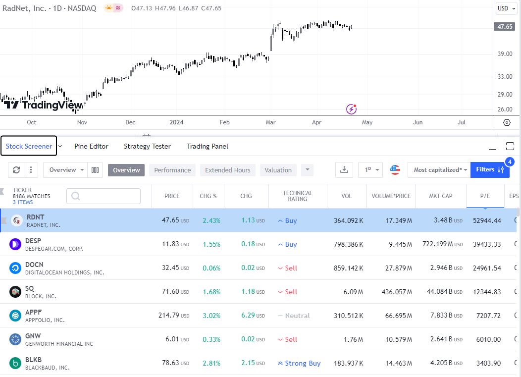TradingView permite buscar acciones sobrevaloradas